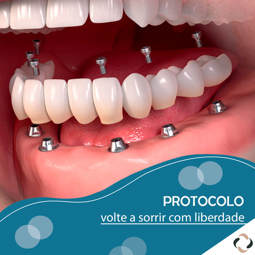 Invisalign - Confortável
